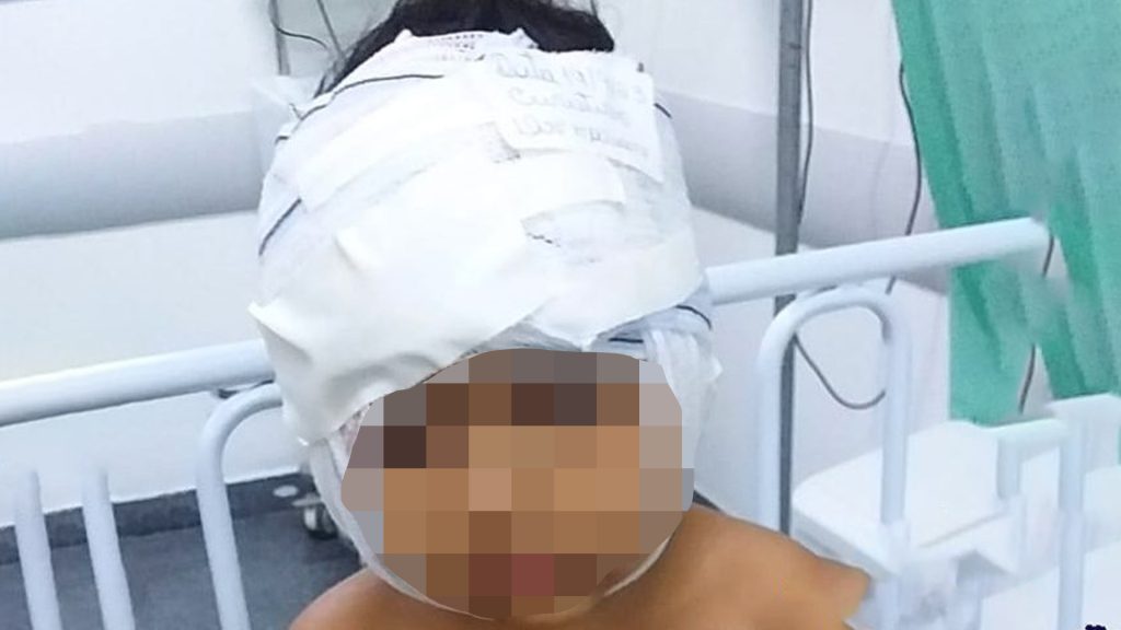 Menino de 4 anos sofre ataque de Pitbull em Ribas do Rio Pardo